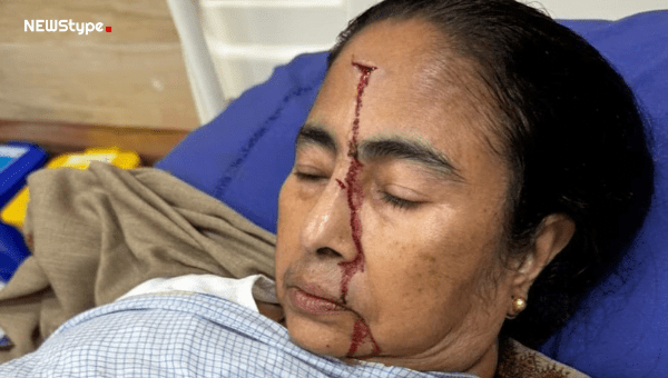 Chief Minister Mamata Banerjee is seriously injured. Forehead burst blood, 4 stitches